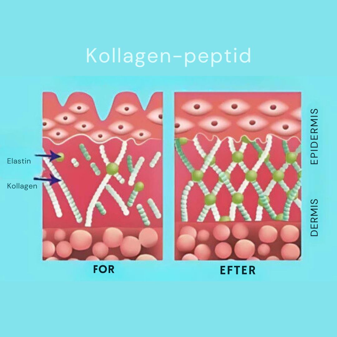 GlowLift™ | Fjern rynker og få en strålende, ungdommelig hud med vores Botox-ansigtsserum – stimulerer cellefornyelse og vender alderen uden nåle