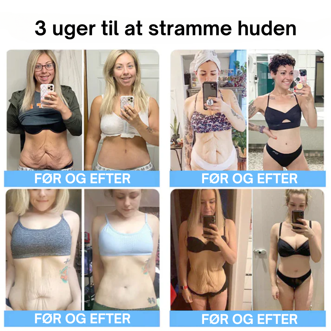 OYIKEY V2 Pro™ OPSTRAMMENDE SERUM med kollagenpeptider - Behandl rynker og slap hud effektivt!