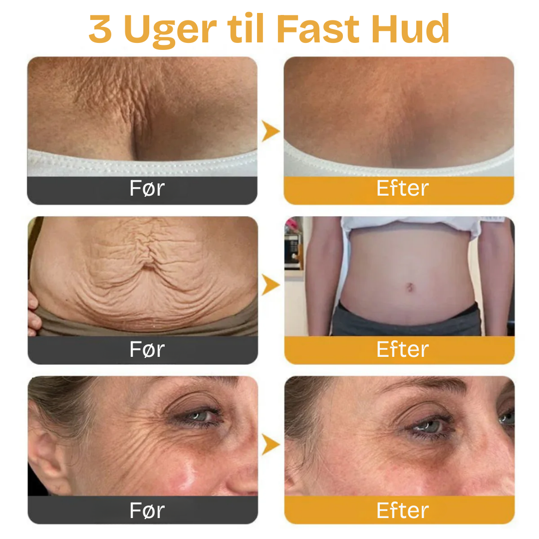 GiftGlød™ | Få en strålende hud med den naturlige kraft fra bi-gift!