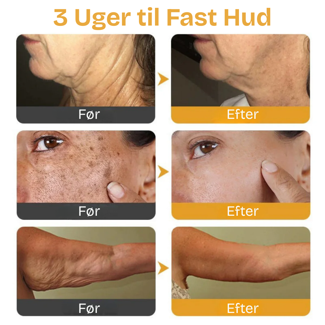 GiftGlød™ | Få en strålende hud med den naturlige kraft fra bi-gift!
