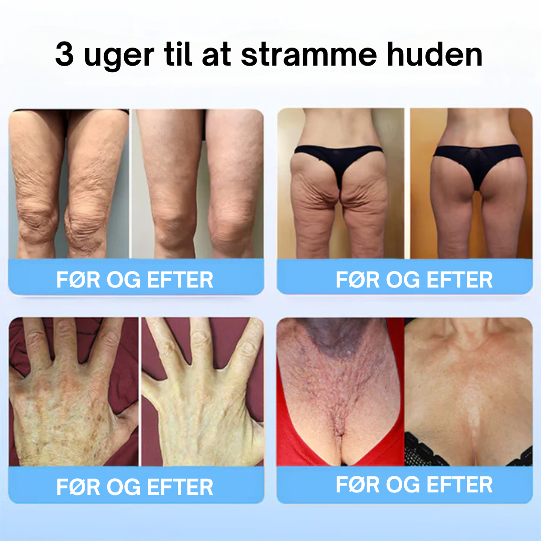 OYIKEY V2 Pro™ OPSTRAMMENDE SERUM med kollagenpeptider - Behandl rynker og slap hud effektivt!