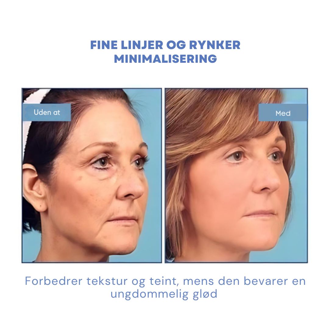 GlowLift™ | Fjern rynker og få en strålende, ungdommelig hud med vores Botox-ansigtsserum – stimulerer cellefornyelse og vender alderen uden nåle