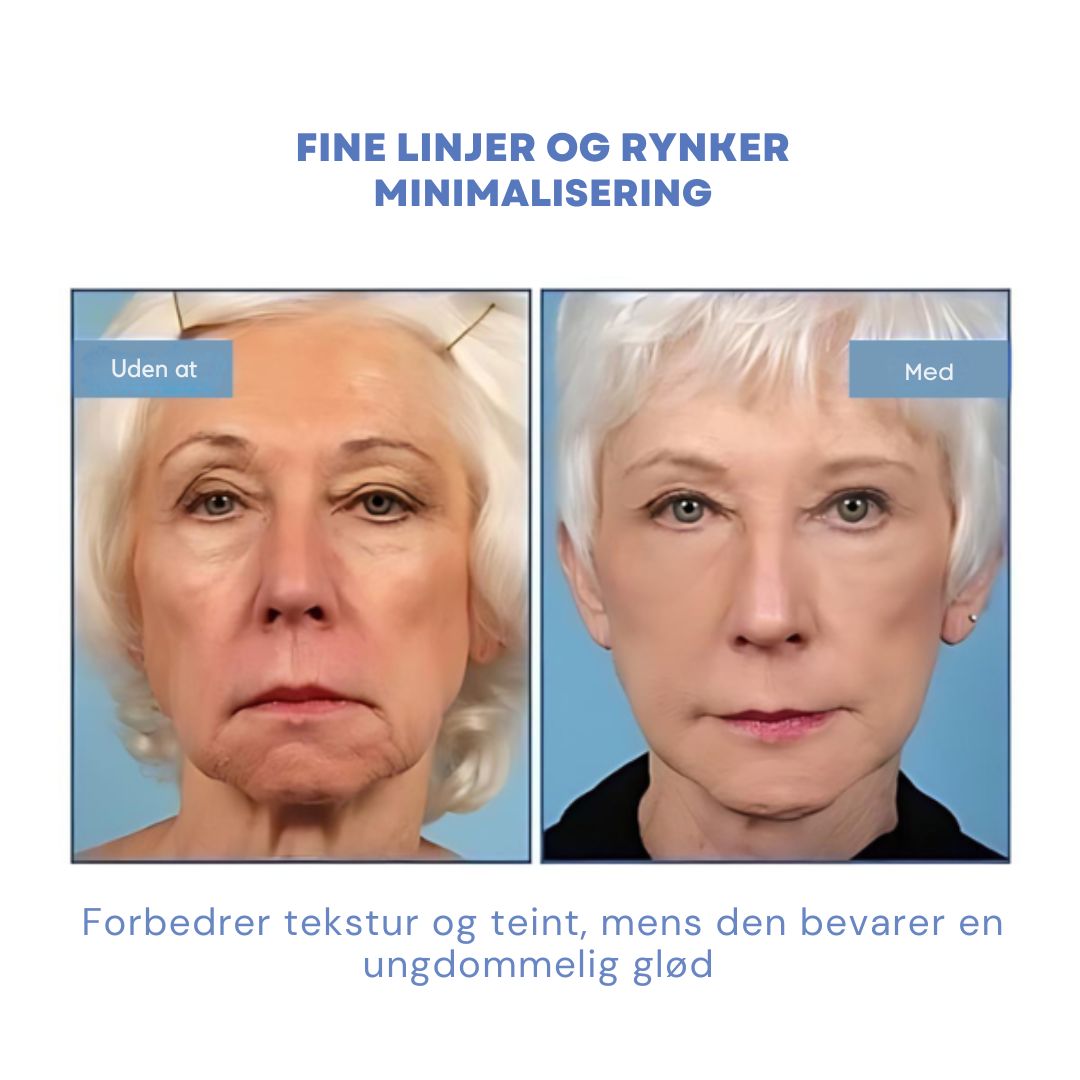 GlowLift™ | Fjern rynker og få en strålende, ungdommelig hud med vores Botox-ansigtsserum – stimulerer cellefornyelse og vender alderen uden nåle