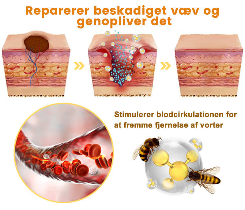 Apivita™ Bikemadsmiddel Behandling Creme - Farvel til hudimperfektioner – Hej til glattere, klarere hud!
