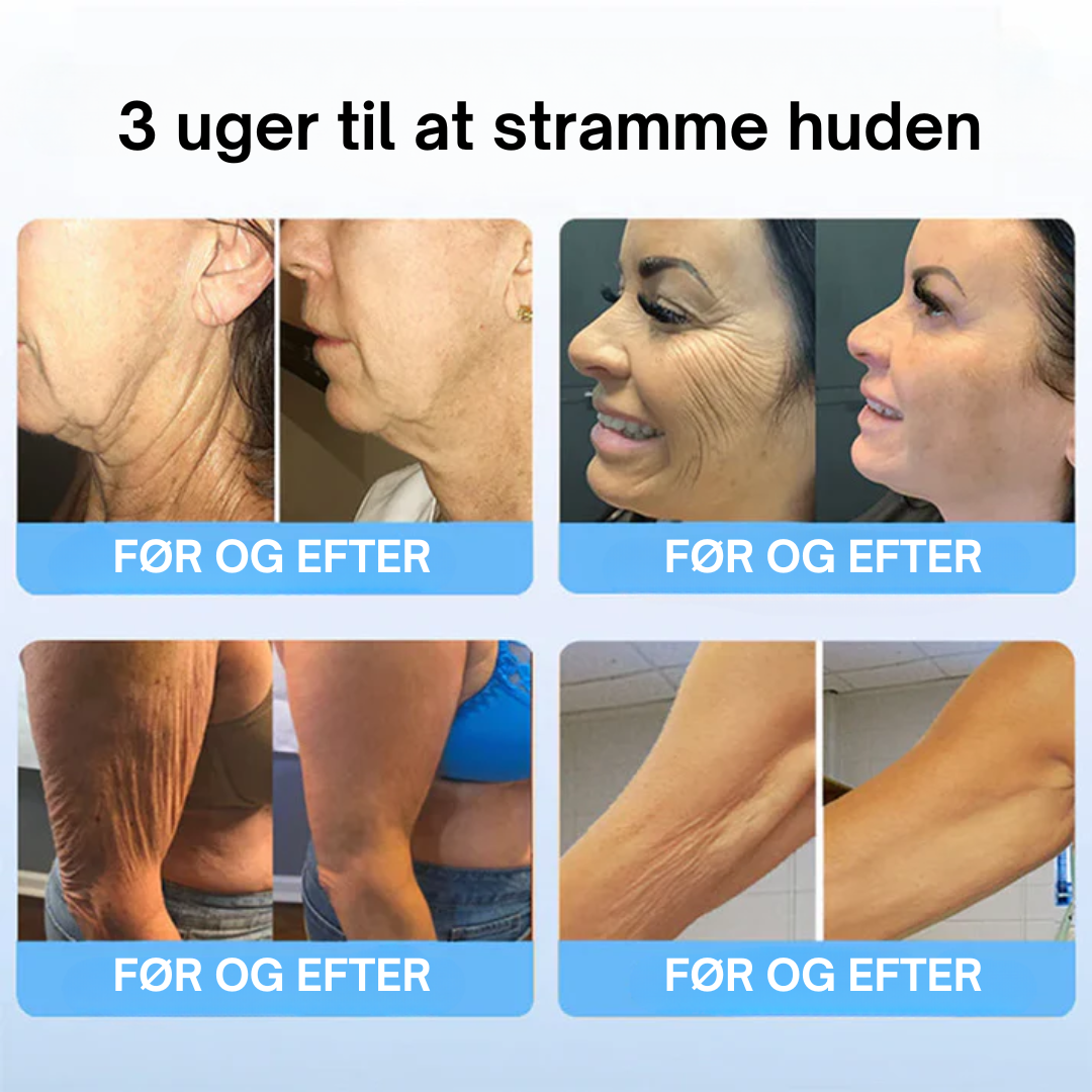 OYIKEY V2 Pro™ OPSTRAMMENDE SERUM med kollagenpeptider - Behandl rynker og slap hud effektivt!