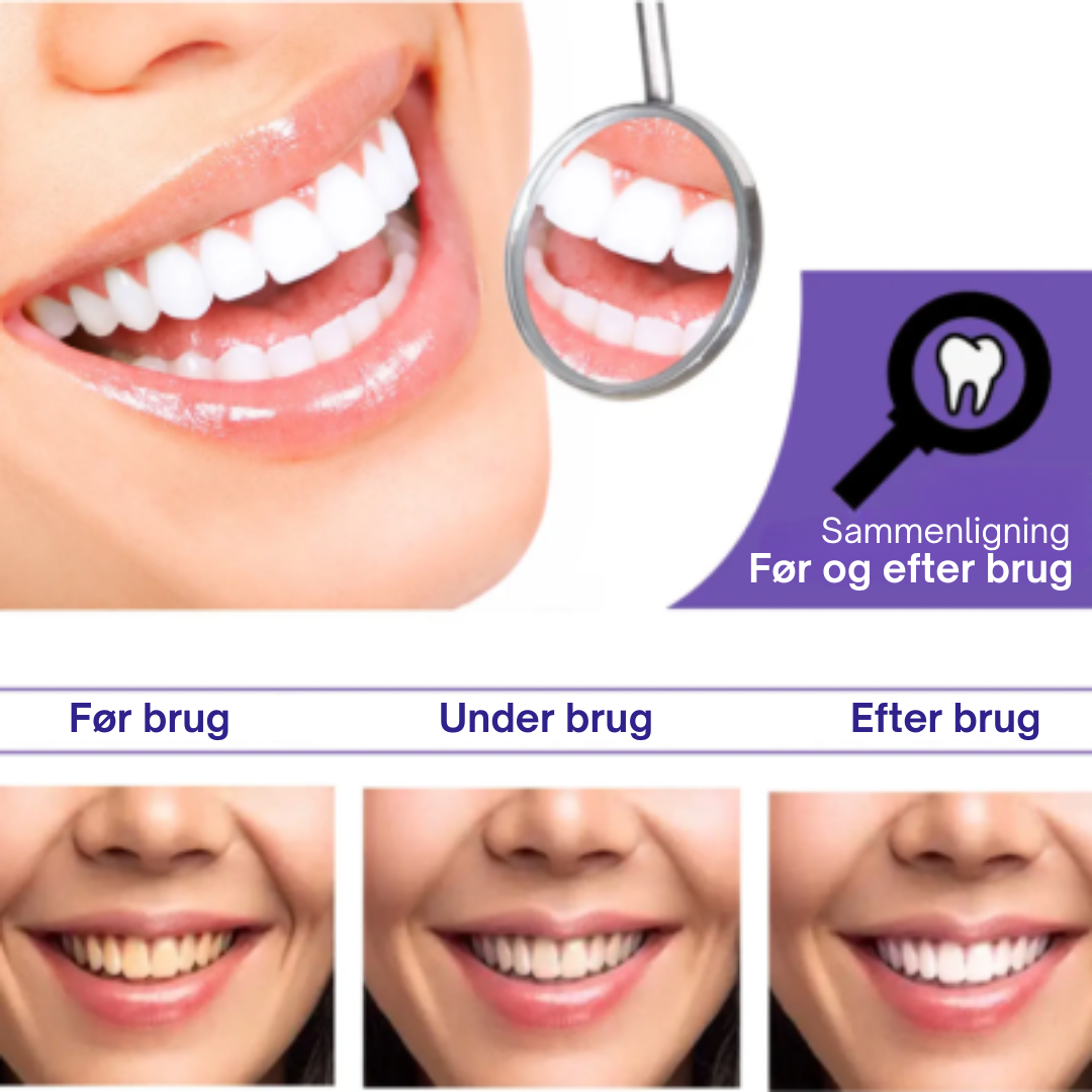 Lys Smil™ | Sig farvel til misfarvning – sig hej til et lysere smil!