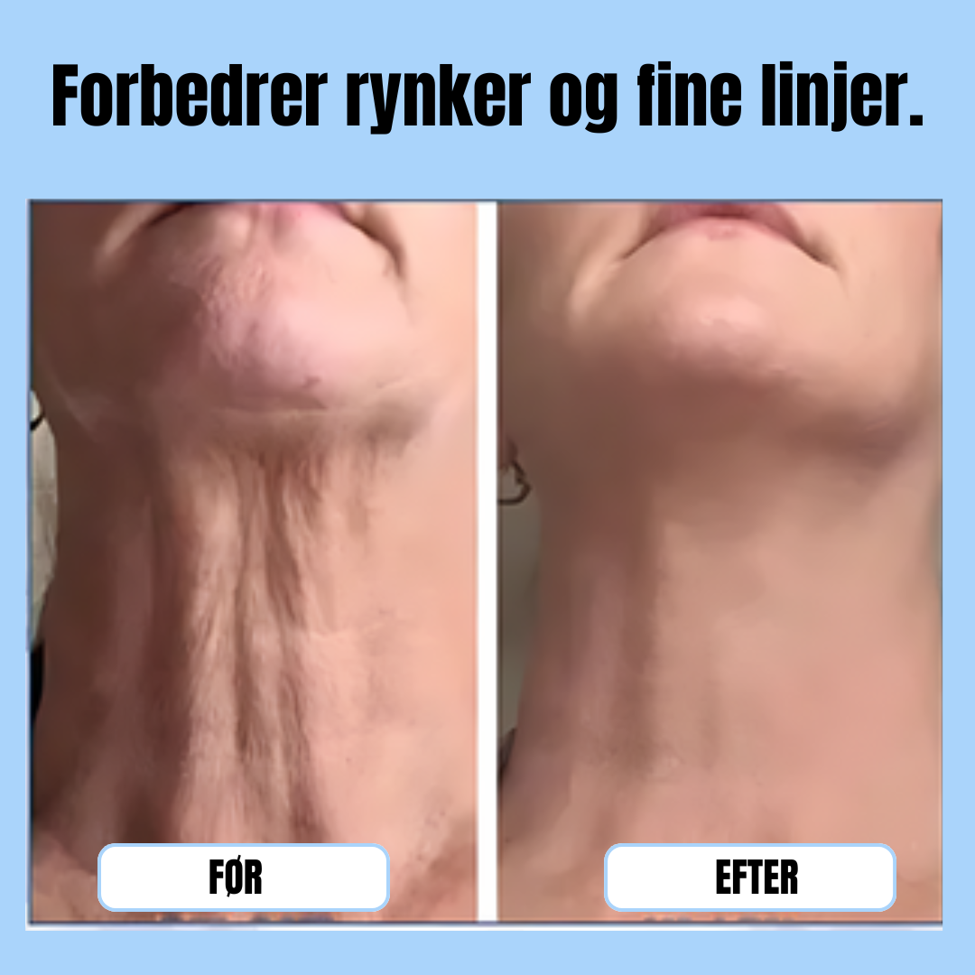 FastLøft™ | Få strammere hud uden besvær – mærk forvandlingen med det samme!