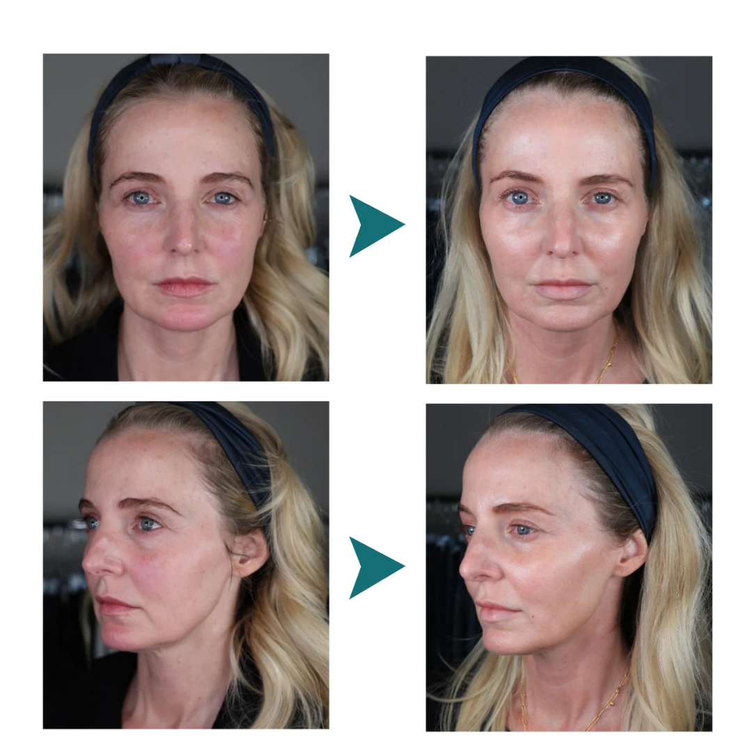 PowerRedo Pro™ | Anti-Aging Creme | Fjerner Rynker & Fine Linjer Med Det Samme!