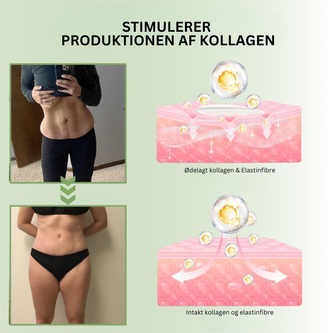 VividSkin™ | Få glattere, yngre hud på kun 7 dage – Ingen nåle, kun resultater!