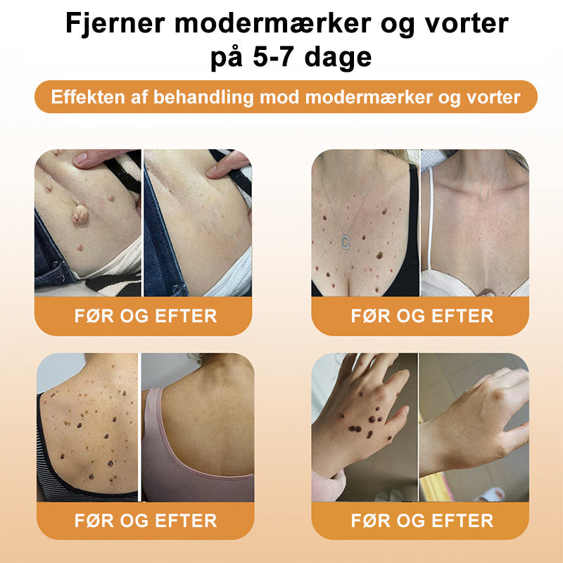 Apivita™ Bikemadsmiddel Behandling Creme - Farvel til hudimperfektioner – Hej til glattere, klarere hud!