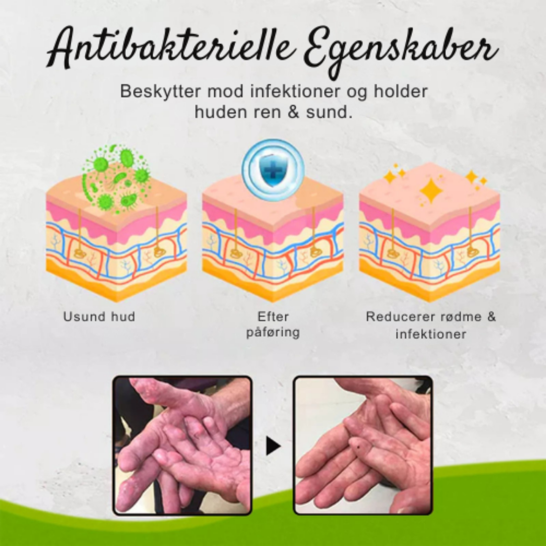 NeuroVive Pro Creme™ | Nulstil din nervepine og oplev øjeblikkelig lindring!