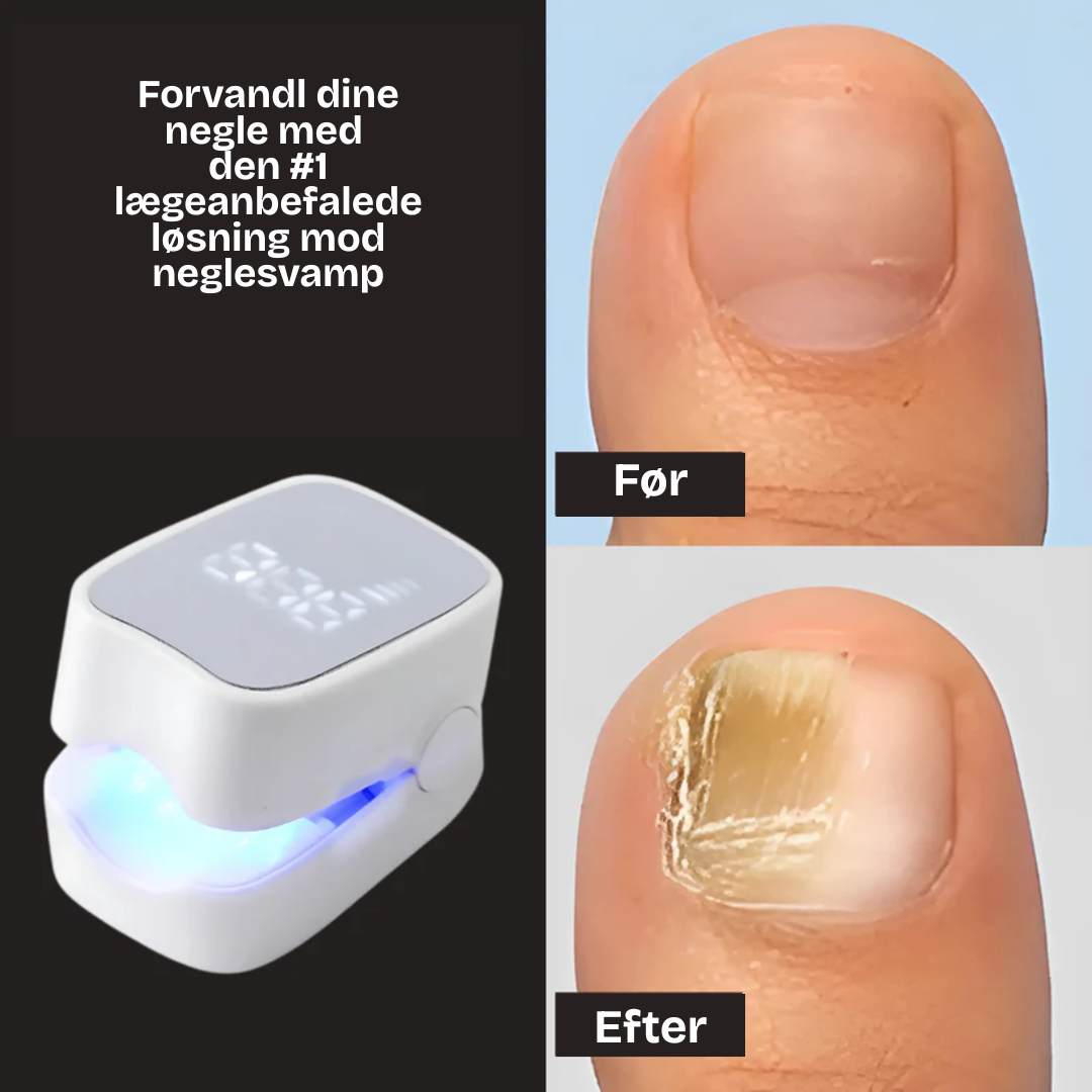 Neglura Pro™ | Fjern neglesvamp uden kemi – få rene, sunde negle med bare 7 minutters brug om dagen!