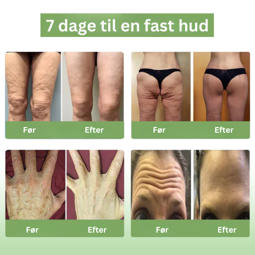 VividSkin™ | Få glattere, yngre hud på kun 7 dage – Ingen nåle, kun resultater!