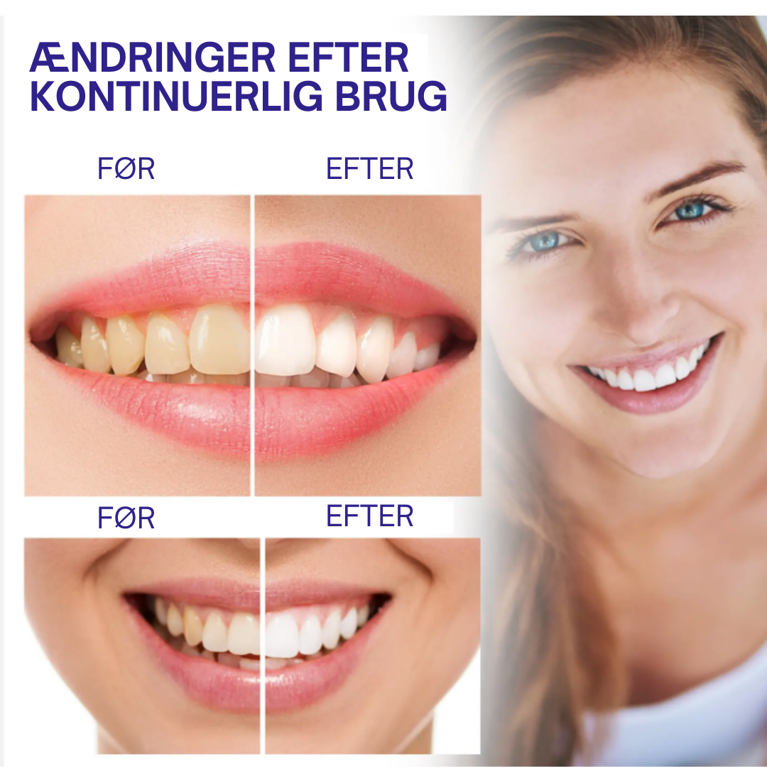Lys Smil™ | Sig farvel til misfarvning – sig hej til et lysere smil!