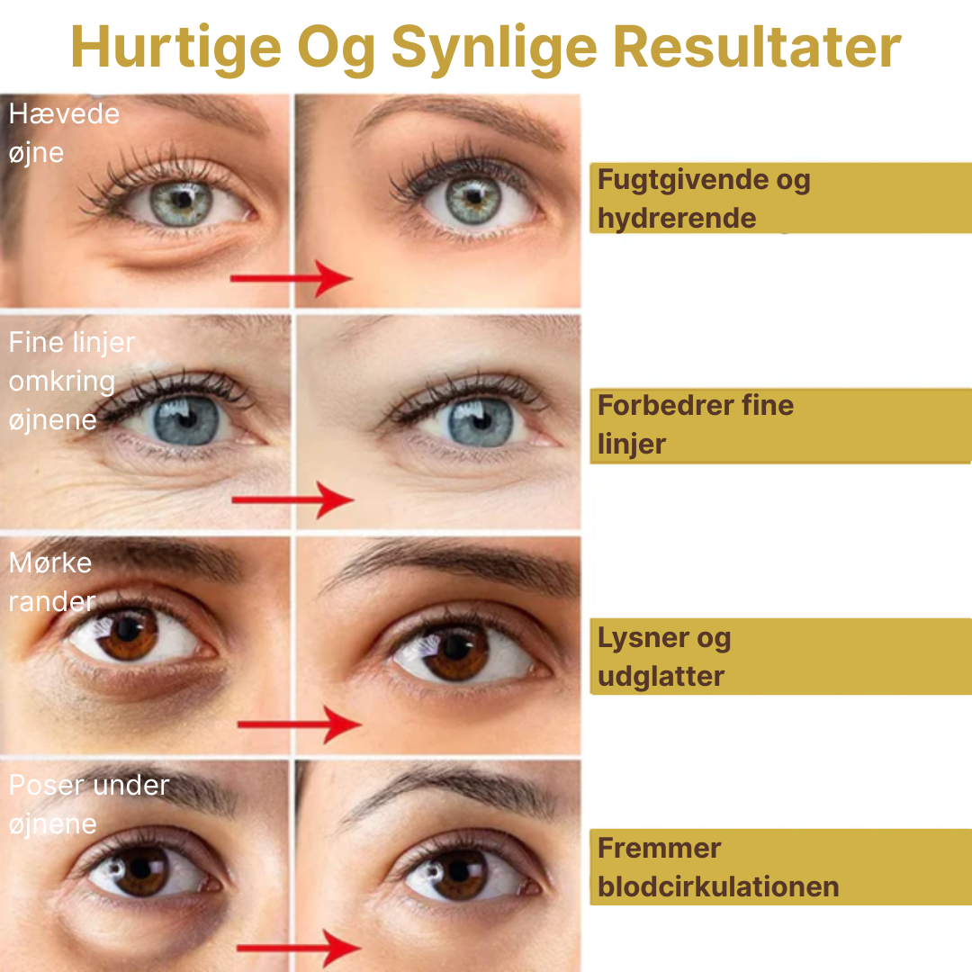 HonningMaske™ | Giv dine øjne den sødeste behandling for en friskere og mere udhvilet følelse!
