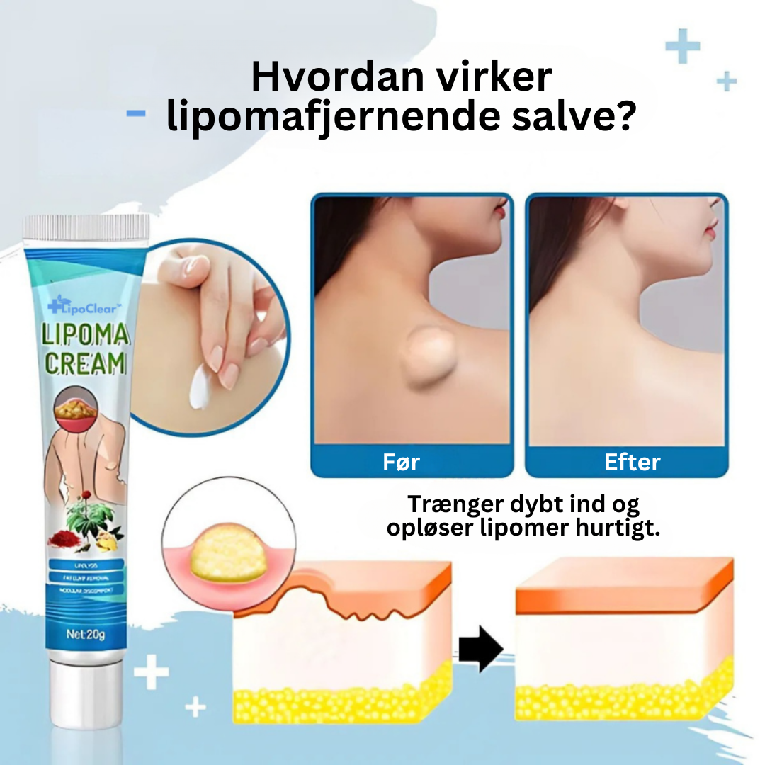 LipoFri™ | Sig farvel til knopper uden besvær—sig hej til glat, knopperfri hud på kun 7 dage!