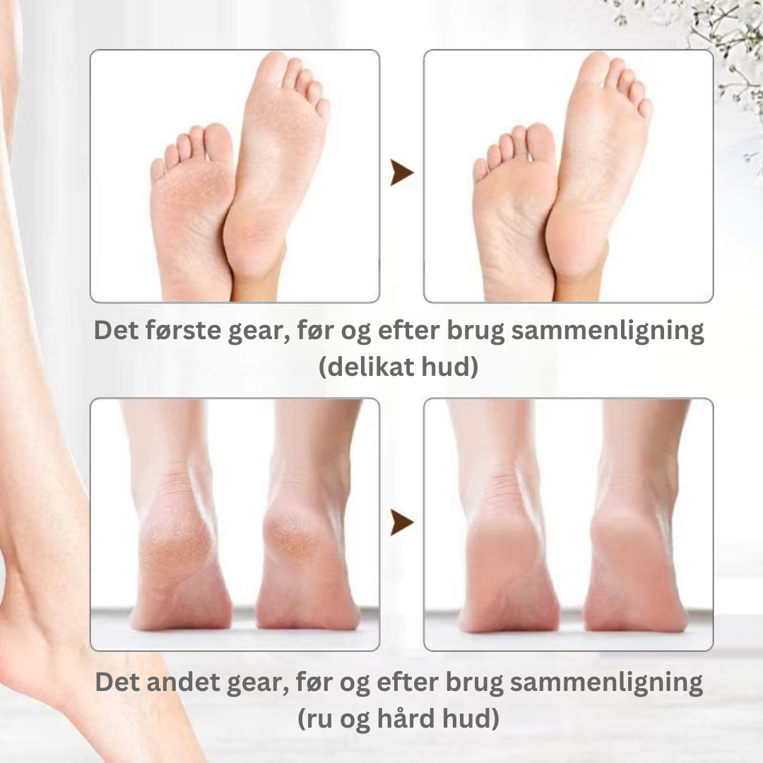 PediLuxe™ V2 Pro | Sig farvel til dyre salonbesøg – opnå glatte, bløde fødder på få minutter, nemt derhjemme!