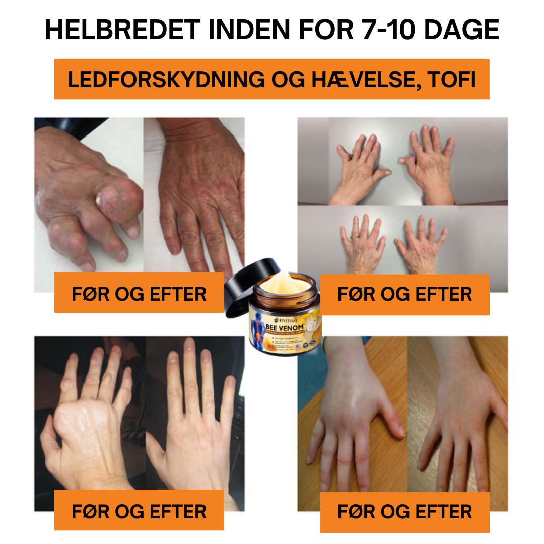 HurtigLindring™ | Sig Farvel til Smerte på Minutter – Hurtig Lindring, Langvarig Komfort!