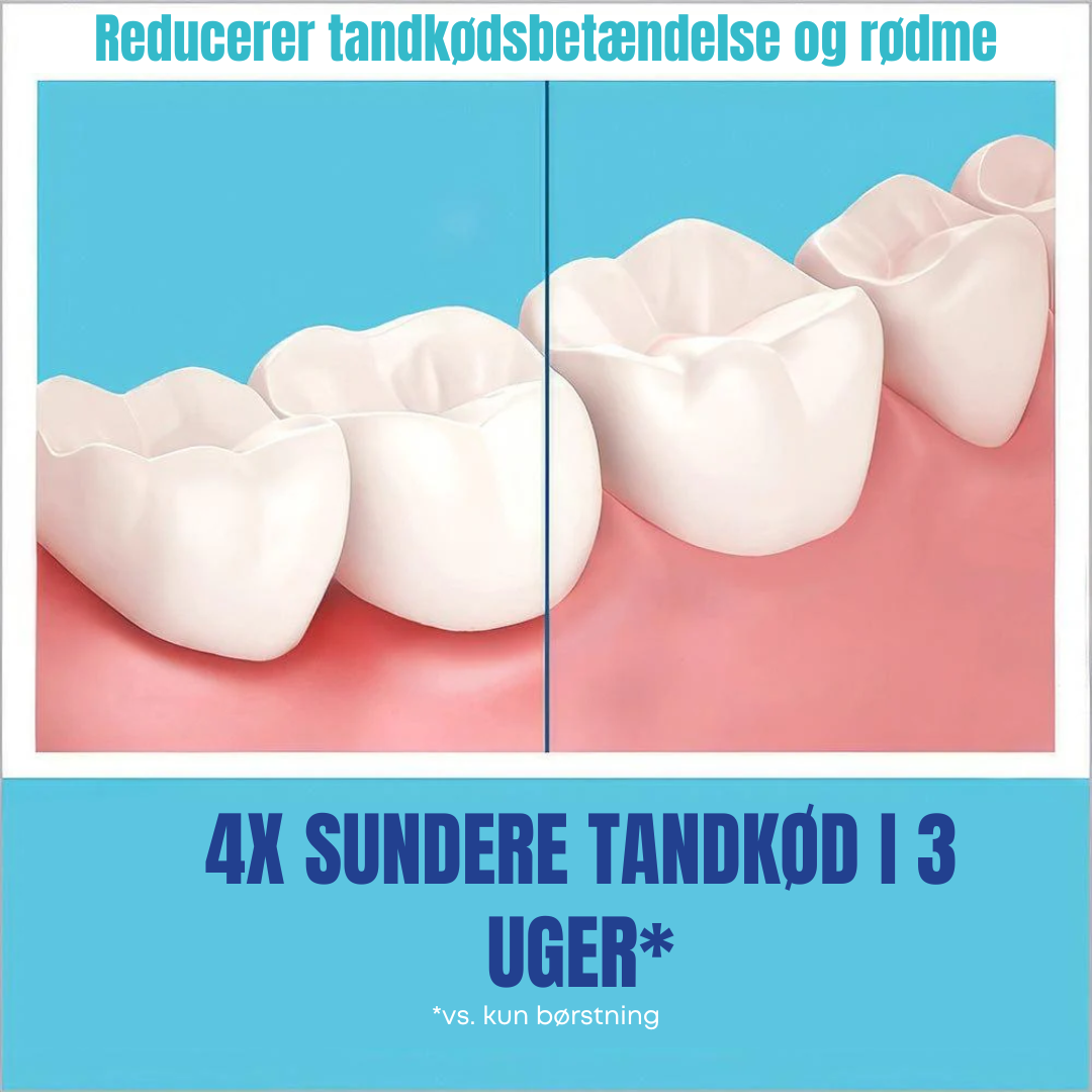 PerfectSmile™ | Få hvidere tænder på få minutter – ingen besvær, kun resultater!