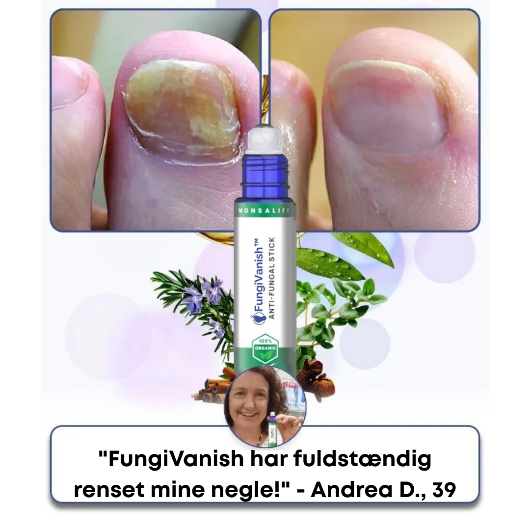FungiVanish Pro™ | Giv dine negle nyt liv og lad dem skinne igen!
