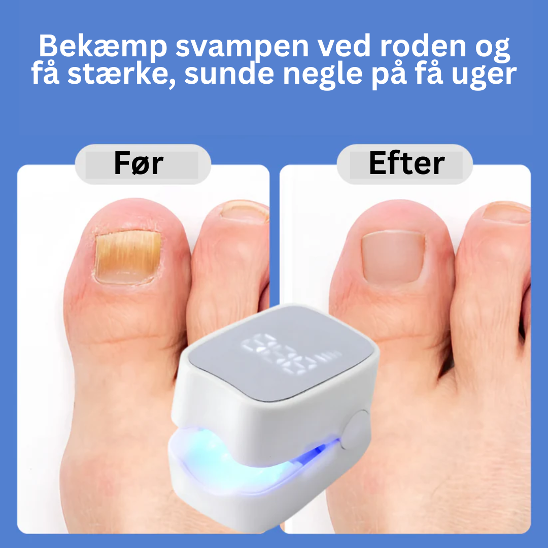 Neglura Pro™ | Fjern neglesvamp uden kemi – få rene, sunde negle med bare 7 minutters brug om dagen!
