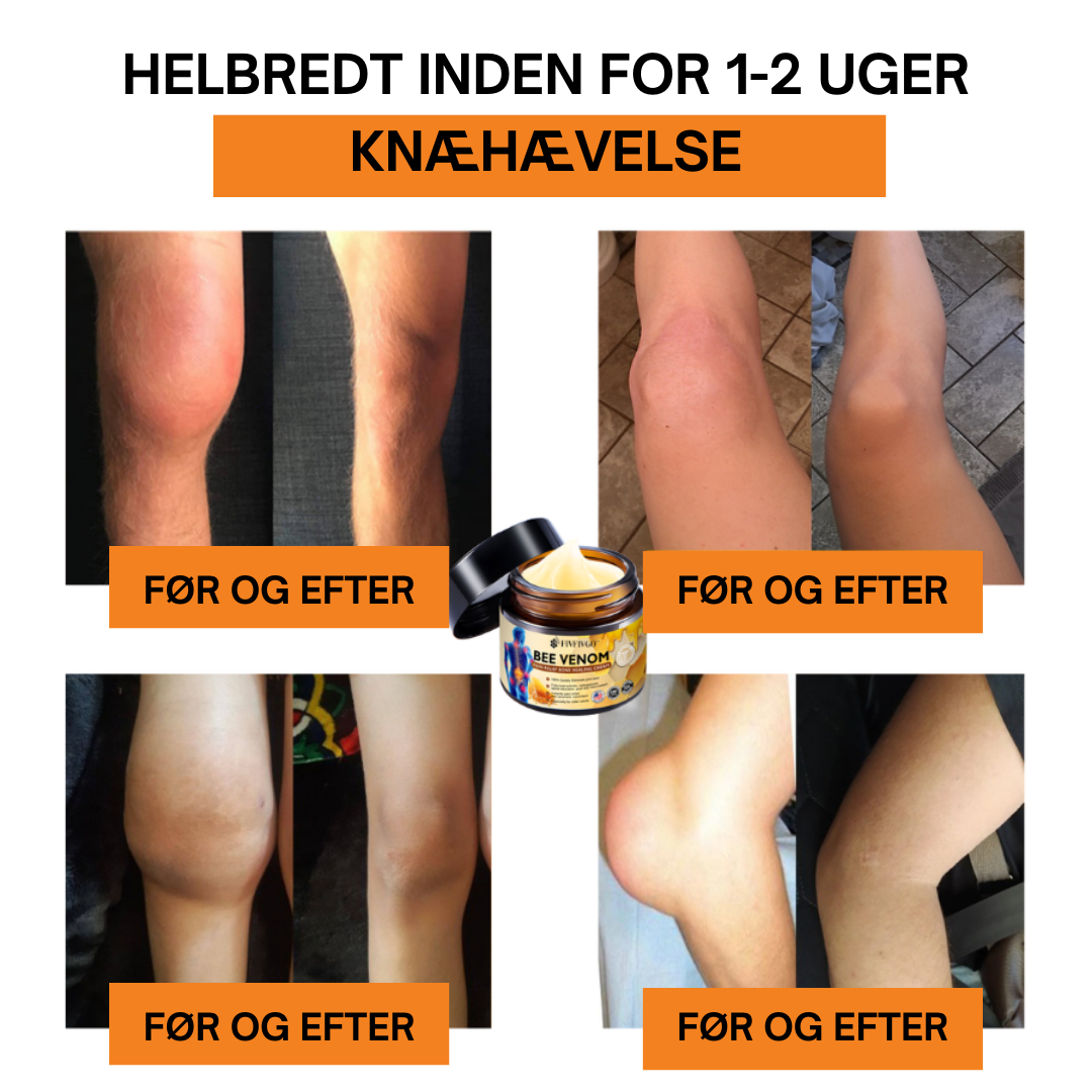 HurtigLindring™ | Sig Farvel til Smerte på Minutter – Hurtig Lindring, Langvarig Komfort!