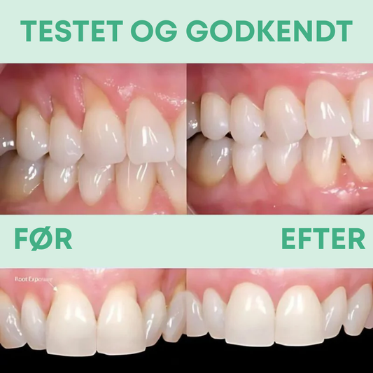 GummiGlød™ | Gør dine gummer glade og dit smil strålende