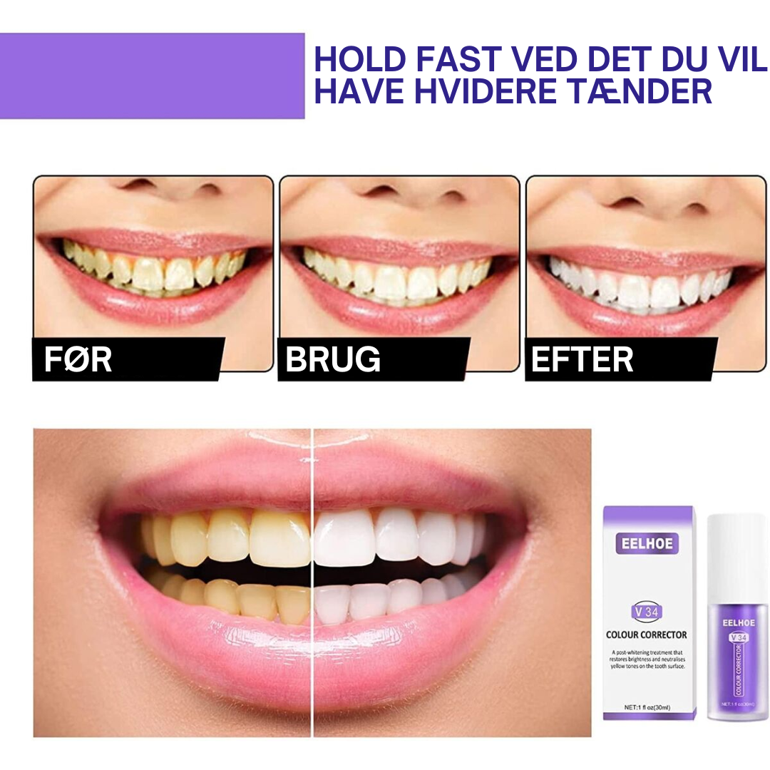 Lys Smil™ | Sig farvel til misfarvning – sig hej til et lysere smil!