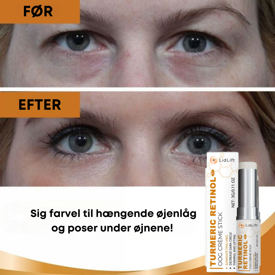 ØjenLøft™ | Øjenlåg Løft Stick | Fjerner Øjenringe & Rynker Med 92% På Kun 2 TIMER!