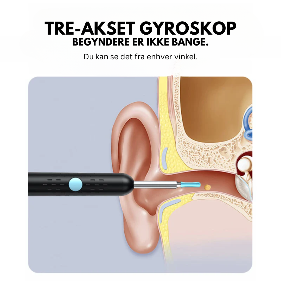 EarCam Pro™ | Se og rengør med præcision, fremtidens nemme ørepleje!