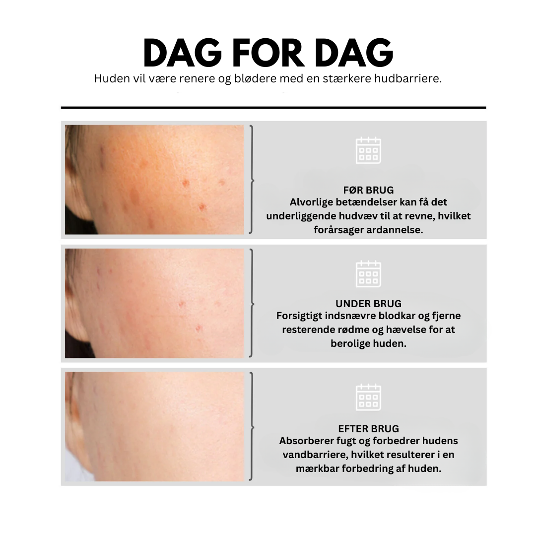 DermaGlow™ - Revolutioner din hudpleje med den ultimative løsning for en glattere, lysere og mere ungdommelig teint!