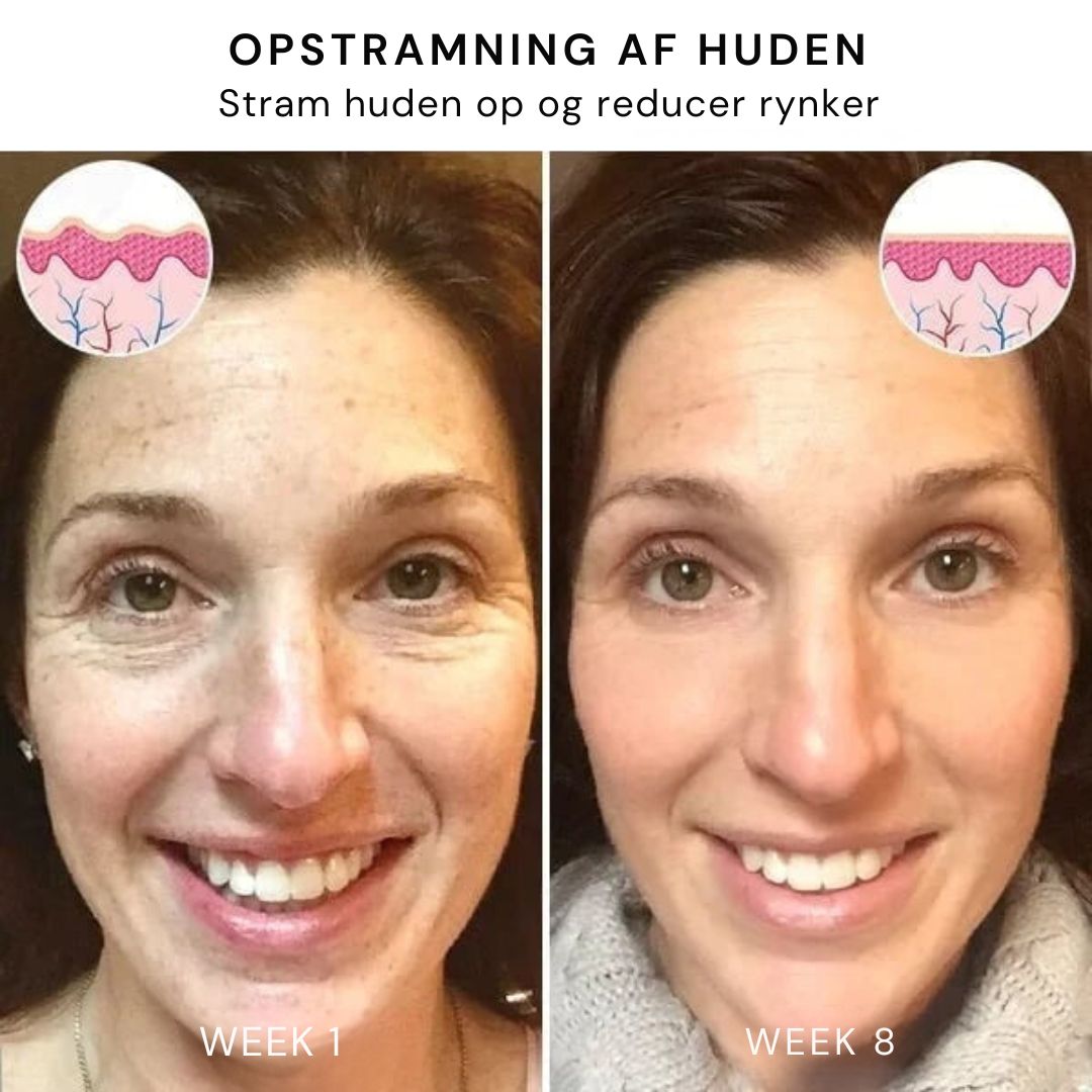 GlowLift™ | Fjern rynker og få en strålende, ungdommelig hud med vores Botox-ansigtsserum – stimulerer cellefornyelse og vender alderen uden nåle