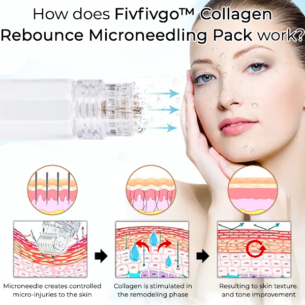 FivFivGo v2 Pro™ Microneedling - siger farvel til rynker og fine linjer, og hej til fast, strålende hud!