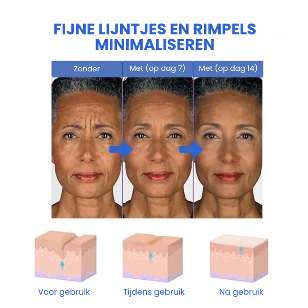 GlowLift™ | Fjern rynker og få en strålende, ungdommelig hud med vores Botox-ansigtsserum – stimulerer cellefornyelse og vender alderen uden nåle