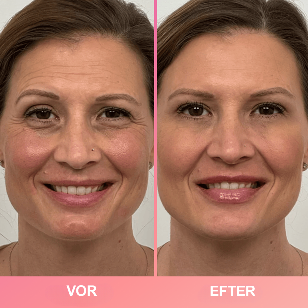 RevitaSkin™ | Forvandl din hud på sekunder – ungdommelig, strålende glød uden besvær!