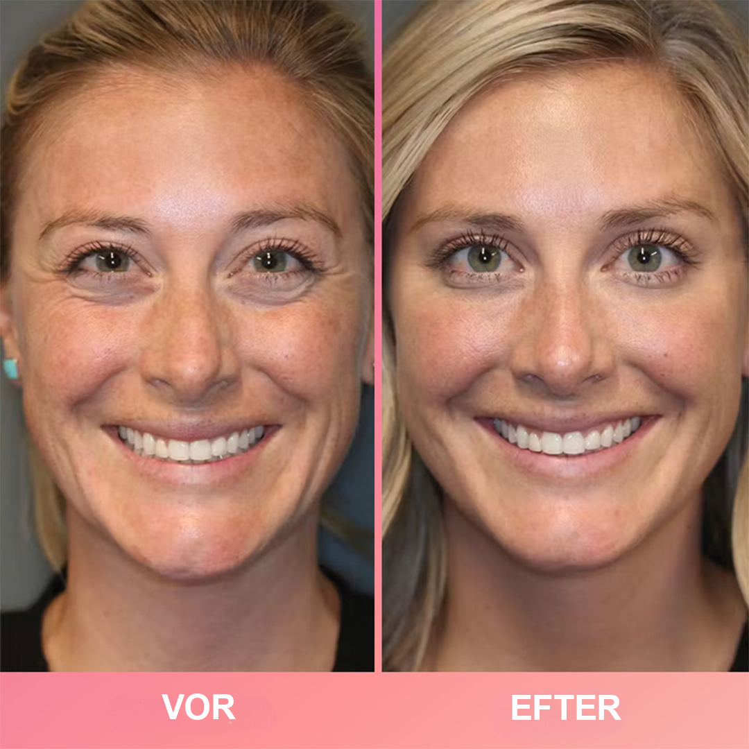 RevitaSkin™ | Forvandl din hud på sekunder – ungdommelig, strålende glød uden besvær!
