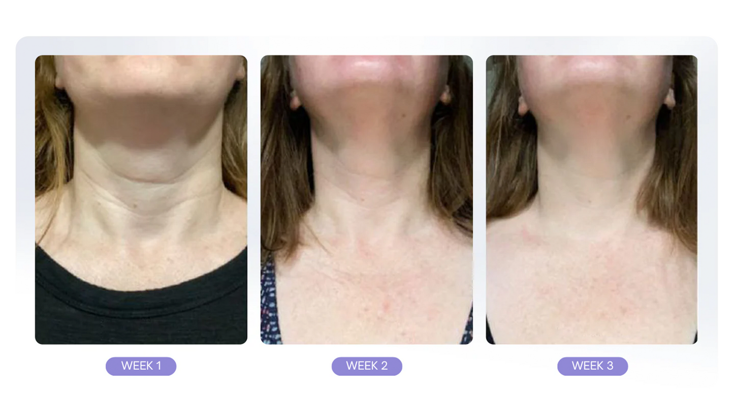 NeckLift™ | Opnå en fastere, glattere hals på få dage – forvandl din hud med naturlige ingredienser!