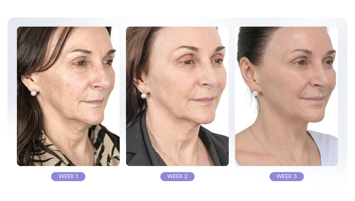 NeckLift™ | Opnå en fastere, glattere hals på få dage – forvandl din hud med naturlige ingredienser!