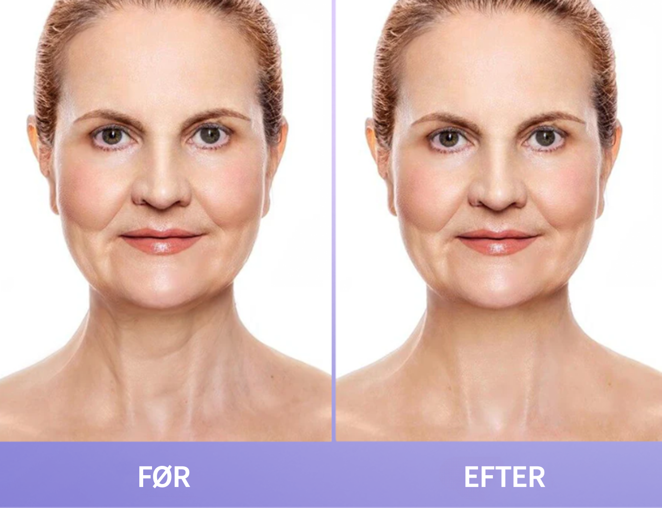 NeckLift™ | Opnå en fastere, glattere hals på få dage – forvandl din hud med naturlige ingredienser!