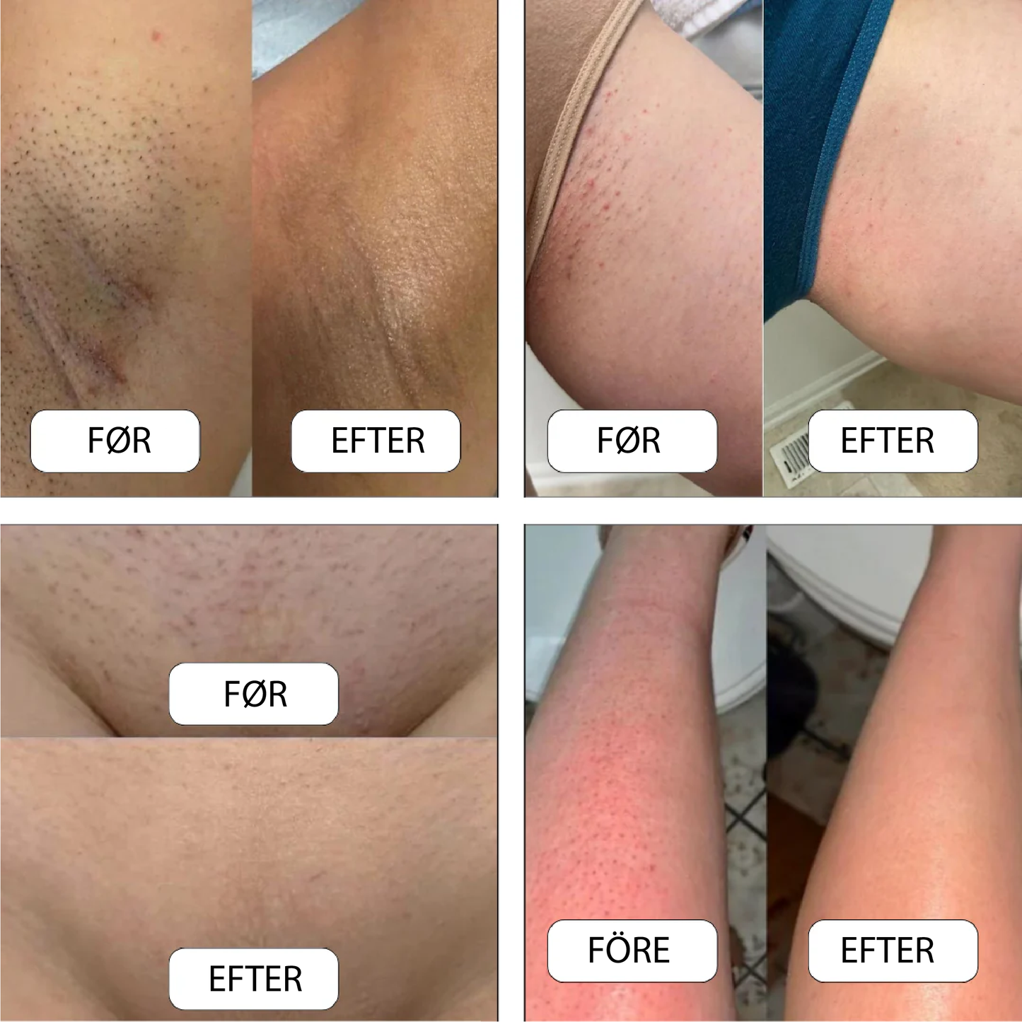 Silkebarber™ | Sig farvel til irritation og snitsår – nyd en glat og fejlfri barbering hver gang!