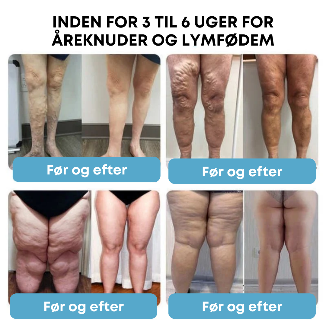 SlimFusion Pro™ - Boost din forbrænding og tab 5 kg på 7 dage med klinisk beviste resultater!