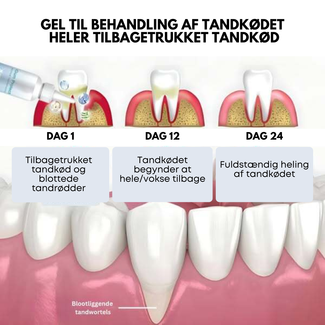 BrightSmile Pro™ | Sig farvel til vigende tandkød, smerter og blødning - genopret tandkødets sundhed på bare 4 dage!