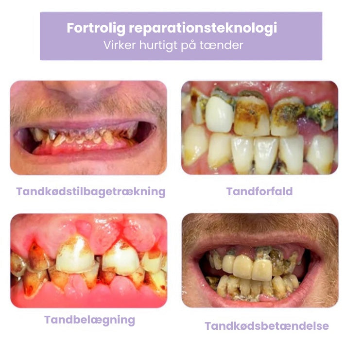 ZenSmile™  - Restaurer dine tænder, frisk ånde, stærkere tandkød – alt i én scoop!
