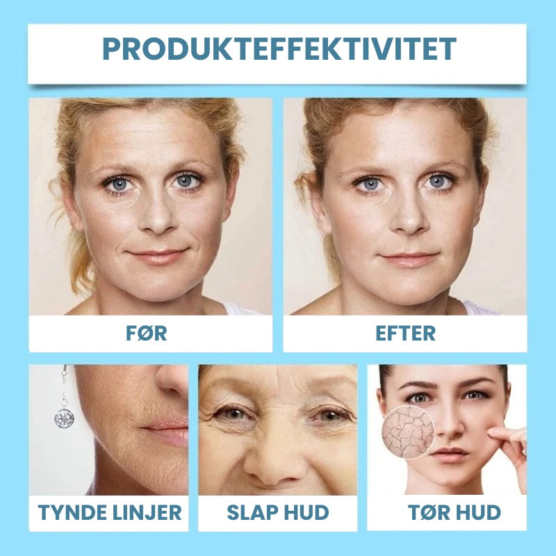 Silkeskind™ | Genoplev dit ungdommelige udseende på bare 5 dage!