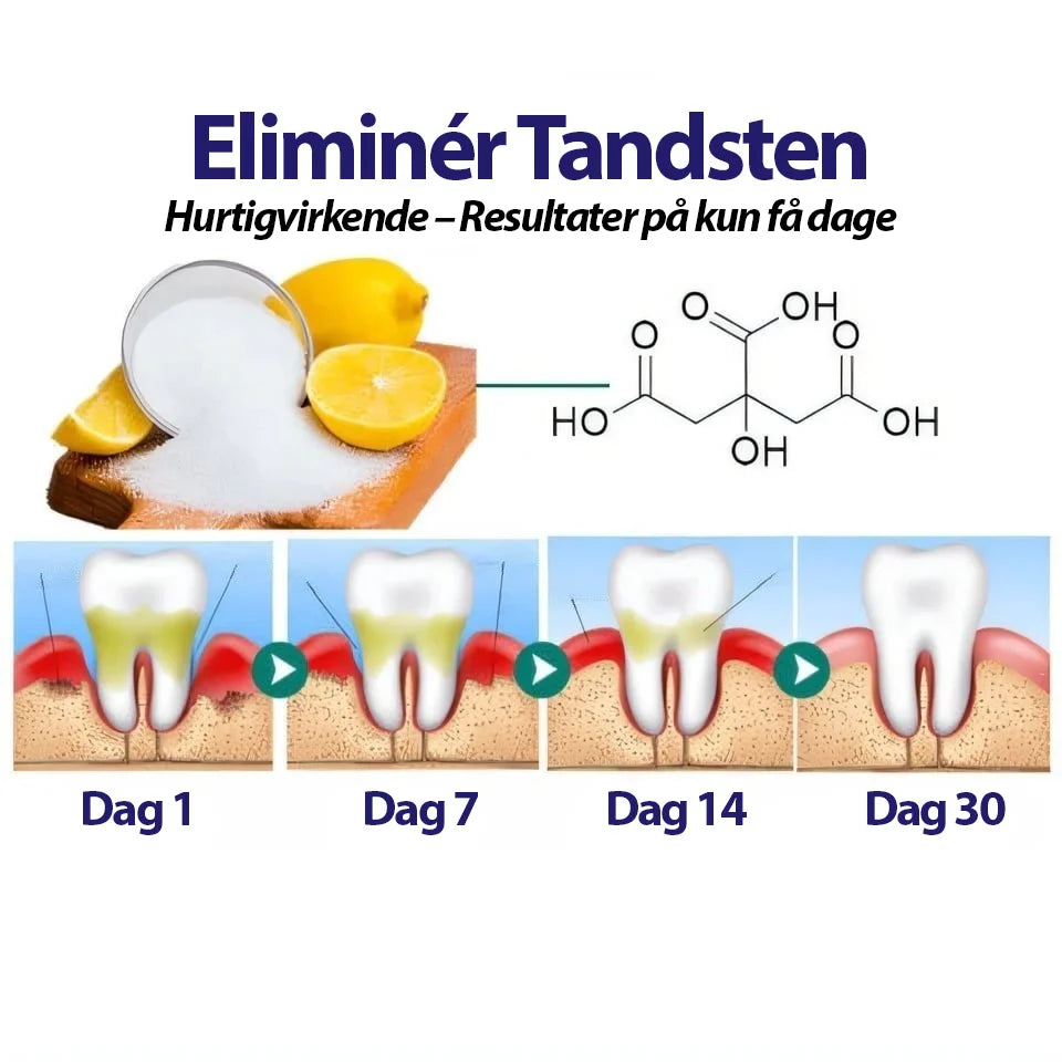 DentiPet V2 Pro™ | Sig farvel til dårlig ånde og tandsten – få en sundere mundhygiejne til din pelsede ven! 🐾
