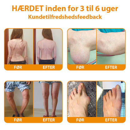 Furzero V3 Pro™ | Bi-gift smertelindrende og ledhelende creme. Anbefalet af Dansk Ortopædisk Selskab (DOS)!