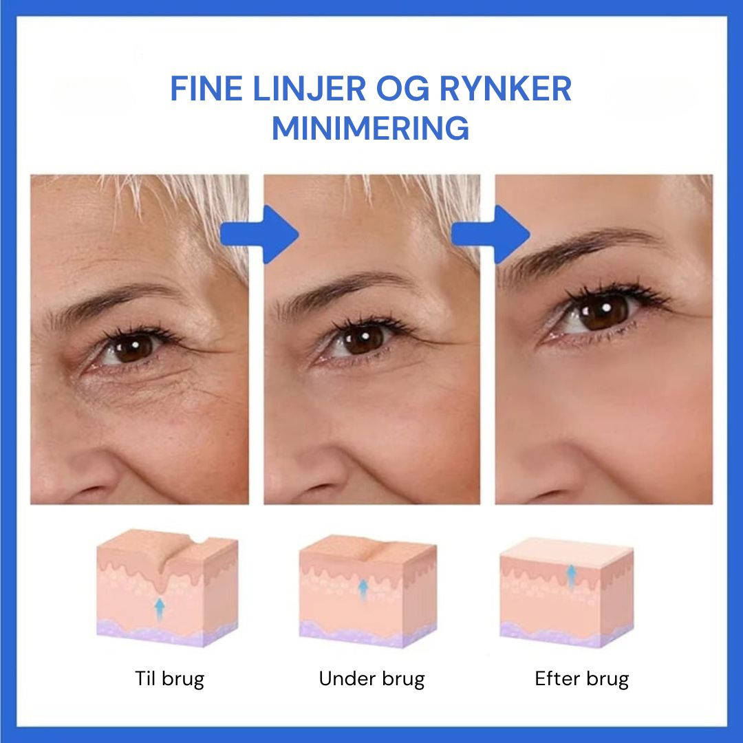 GlowLift™ | Fjern rynker og få en strålende, ungdommelig hud med vores Botox-ansigtsserum – stimulerer cellefornyelse og vender alderen uden nåle