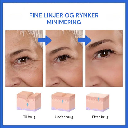 GlowLift™ | Fjern rynker og få en strålende, ungdommelig hud med vores Botox-ansigtsserum – stimulerer cellefornyelse og vender alderen uden nåle