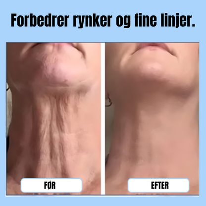 FastLøft™ | Få strammere hud uden besvær – mærk forvandlingen med det samme!