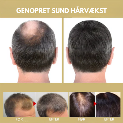 HårGlød Pro™ - Infrarød Hårterapi Kasket | Stimuler hårvækst, reducer brud og revitaliser dit hår med den beroligende varme fra avanceret infrarød teknologi.